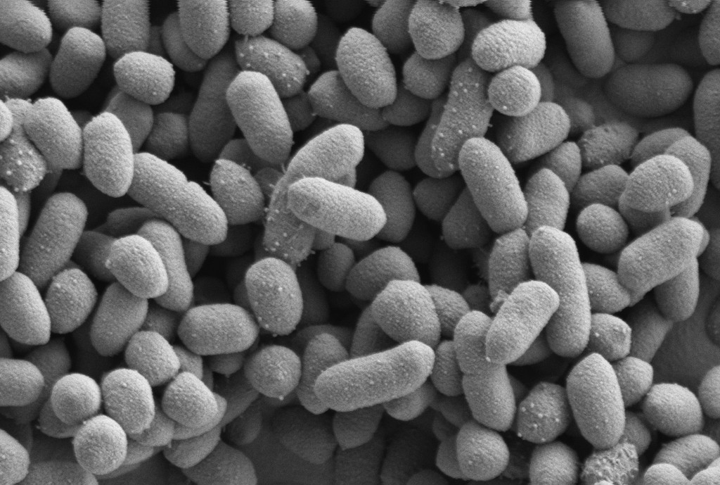 Resim: Bağırsaklardaki Bacteroid sınıfından Bacteroides thetaiotaomicron’un görünümü (http://news.ifr.ac.uk/2014/02/gut-bacteria-communication/ adresinden alımıştır) 